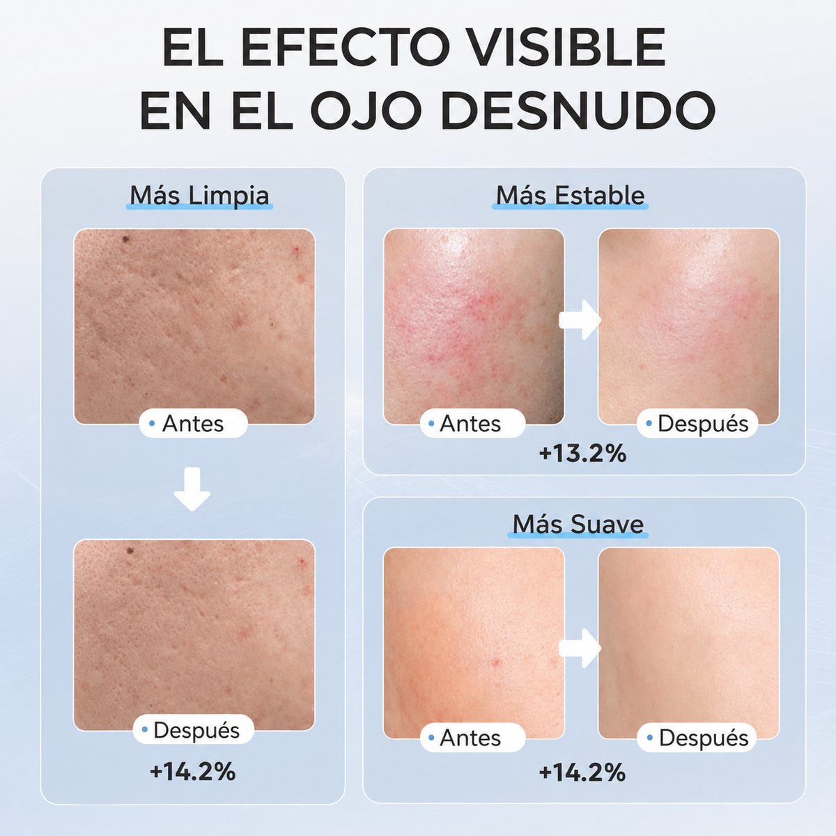 Máscara facial LED con Terapia de Luz Roja para la Cara y la Piel