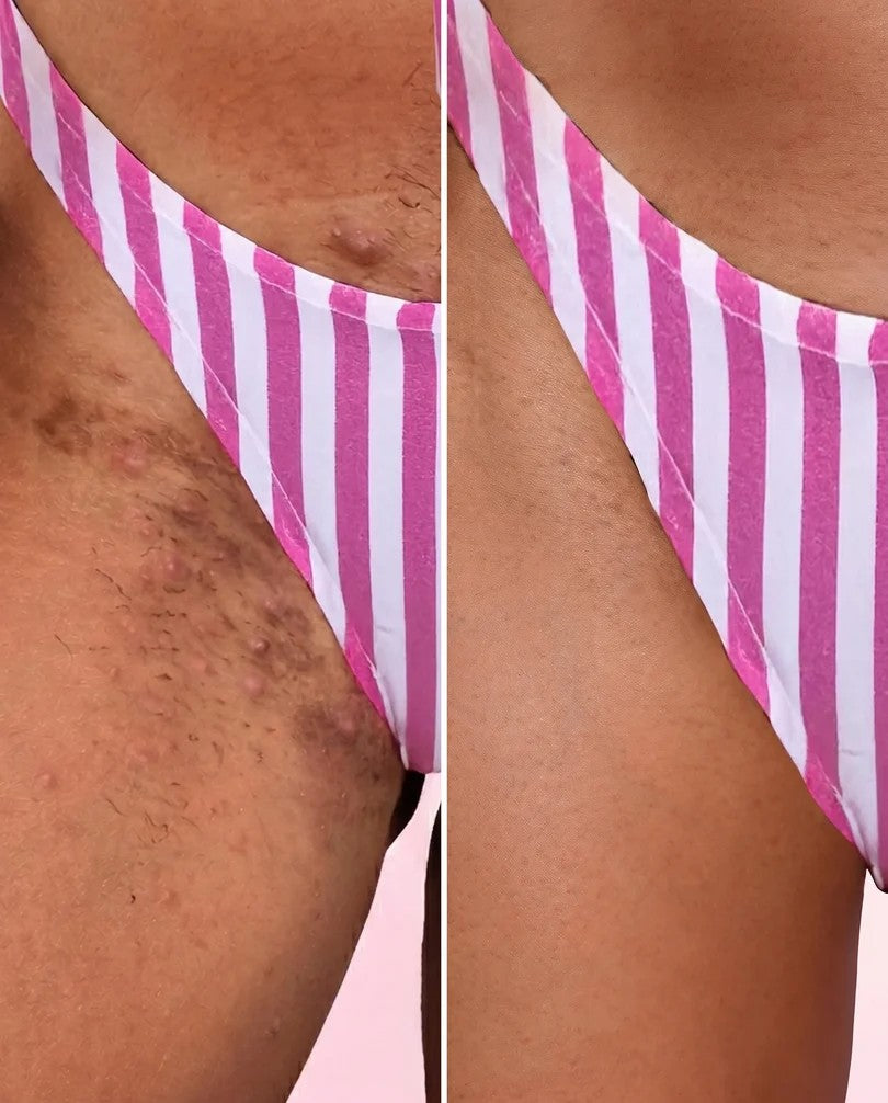 Bella Skin 3 en 1 – Loción Corporal Hidratante y Aclarante - additional image 1